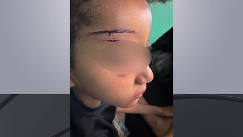 Niño hispano de 9 años aterrorizado luego de ser víctima de una golpiza mientras jugaba con un...